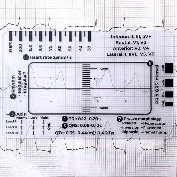 MediTrack – Professional ECG Assessment Pocket Guide