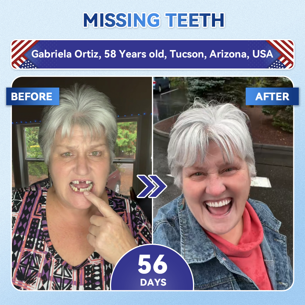 Your Smile~ NESLEMY® 🦷 Tideglusib Fast‑Dissolving Tooth & Gum Repair Oral Strips ✨ (𝟓-𝐢𝐧-𝟏 💎 𝐑𝐞𝐛𝐮𝐢𝐥𝐝 𝐄𝐧𝐚𝐦𝐞𝐥 & 𝐃𝐞𝐧𝐭𝐢𝐧 • 𝐒𝐭𝐫𝐞𝐧𝐠𝐭𝐡𝐞𝐧 𝐆𝐮𝐦𝐬 • 𝐄𝐫𝐚𝐝𝐢𝐜𝐚𝐭𝐞 𝐓𝐚𝐫𝐭𝐚𝐫 & 𝐎𝐝𝐨𝐫 • 𝐖𝐡𝐢𝐭𝐞𝐧𝐢𝐧𝐠 • 𝐒𝐭𝐨𝐩 𝐓𝐨𝐨𝐭𝐡 𝐒𝐞𝐧𝐬𝐢𝐭𝐢𝐯𝐢𝐭𝐲)