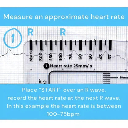 MediTrack – Professional ECG Assessment Pocket Guide