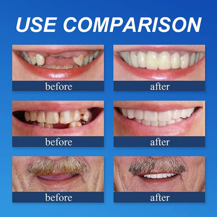 🌎Ends Today: 70% OFF! ⏰Yagoo™ Medical Full Denture with Strong Suctiond🦷Obtain American Dental Association (ADA) Certification