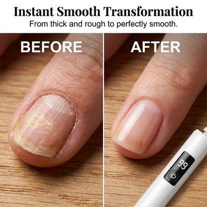 FlawlessTouch – Nail Drill & Buffing System